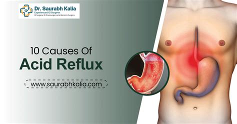10 Causes Of Acid Reflux Dr Saurabh Kalia