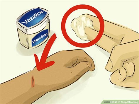 3 Ways To Stop Bleeding Wikihow