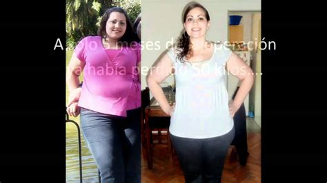 Alejandra S Gastric Bypass From 286 Lbs To 147 Ale Y Su