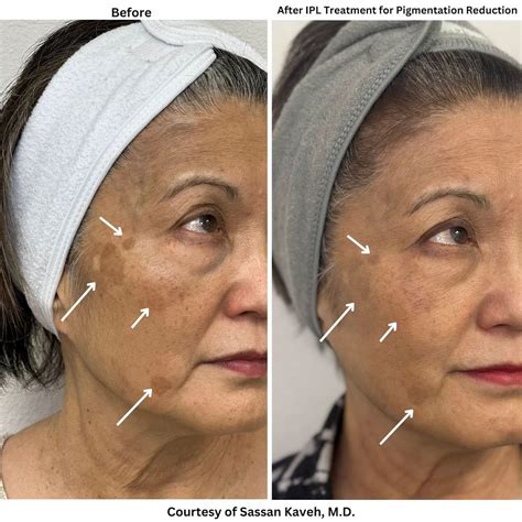 Alpha Medical Aesthetics Medical Spa Las Vegas Nv Alpha Medical Aesthetics Medical Spa Las Vegas Nv