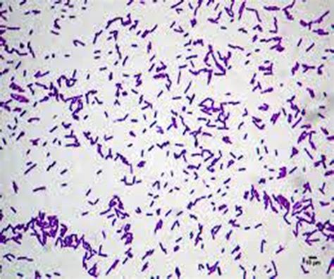 Bacillus Cereus Gram Stain: Unveiling Critical Diagnostic Insights