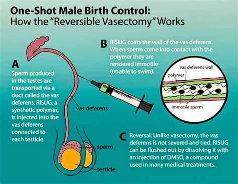 Birth Control Gel For Men