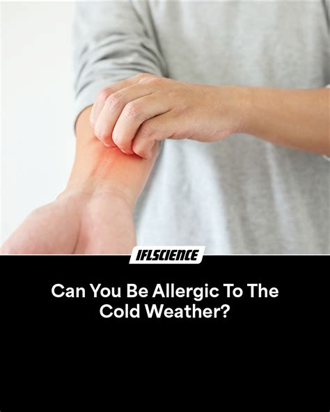 Can You Be Allergic To The Cold Weather Iflscience