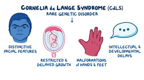 Cornelia De Lange Syndrome What Is It Causes Signs Symptoms Osmosis