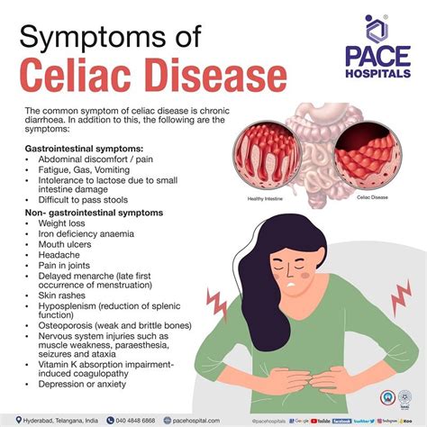 Disorders Associated With Celiac Disease