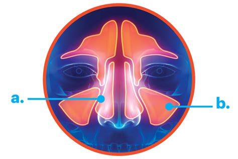 How To Clear Up Sinus Problems Treatments Strategies