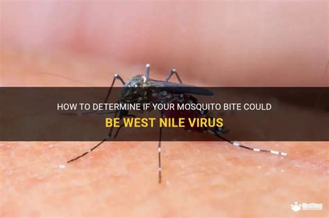 How To Determine If Your Mosquito Bite Could Be West Nile Virus Medshun How To Determine If Your Mosquito Bite Could Be West Nile Virus Medshun