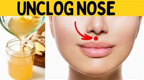 How To Unclog Your Nose Instantly Heyallergy How To Unclog Your Nose Instantly Heyallergy