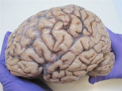 Human Brain Wikipedia