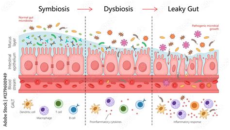 Is Leaky Gut Real The Science Of Intestinal Permeability Is Leaky Gut Real The Science Of Intestinal Permeability