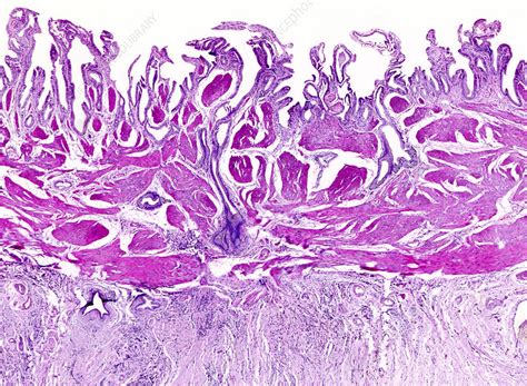 Jcdr 8 Nd05 G004 Jpg