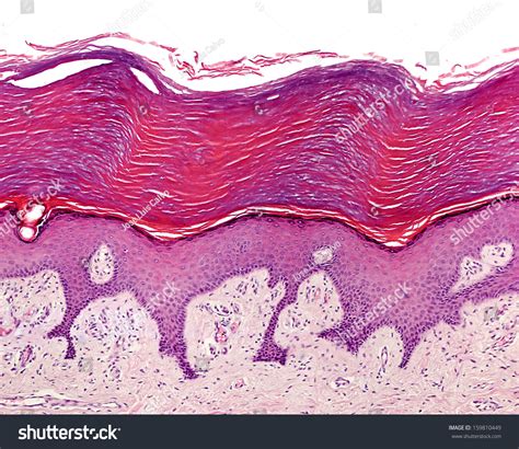 Keratinized Stratified Squamous Epithelium Unveiled