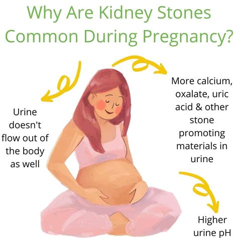 Kidney Stones in Pregnancy: Urgent Care Tips