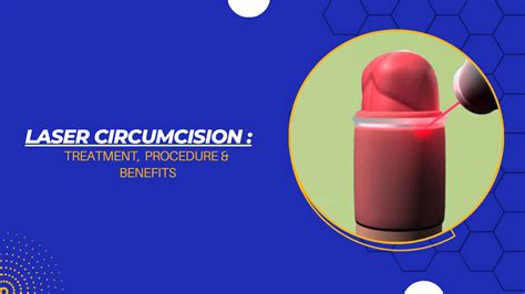 Laser Circumcision Benefits Risks Procedure And Recovery