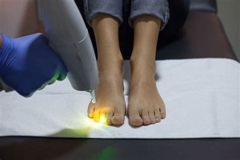 Laser Treatment For Nail Fungus What You Need To Know Foot Ankle Laser Treatment For Nail Fungus What You Need To Know Foot Ankle