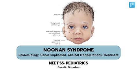 Noonan Syndrome Physiopedia