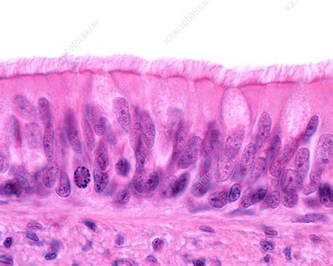Pseudostratified Ciliated Columnar Epithelium Insights