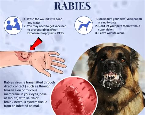 Rabies Midwives Revision