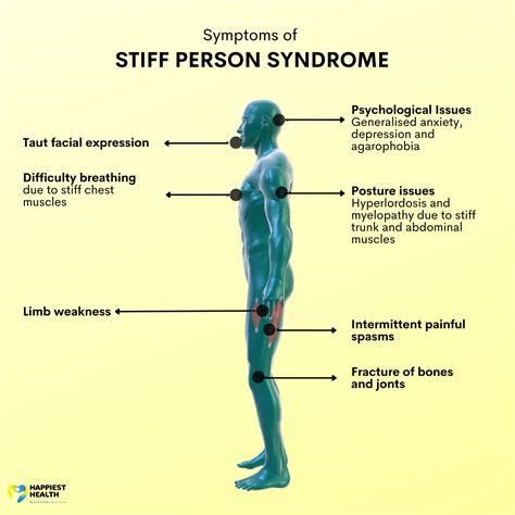 Stiff Man Syndrome Photos
