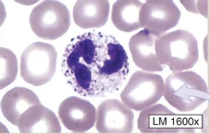 The Path O Less Taken Flashcards Quizlet
