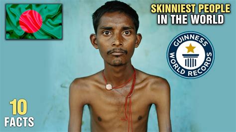 The Skinniest Person In The World Guinness World Record