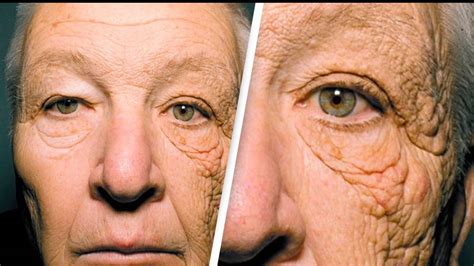 Truck Driver Spent 28 Years Driving Without Sun Protection National Sunscreen Day Youtube Truck Driver Spent 28 Years Driving Without Sun Protection National Sunscreen Day Youtube