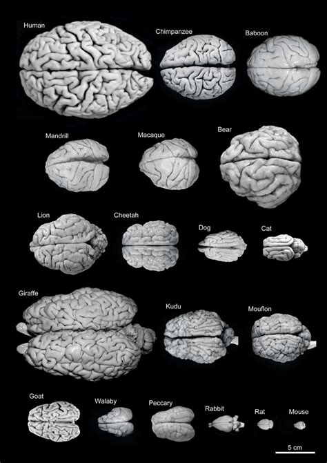 Variability Of Brain Size And External Topography Photographs And