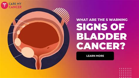 5 Signs of Bladder Cancer You Can't Ignore