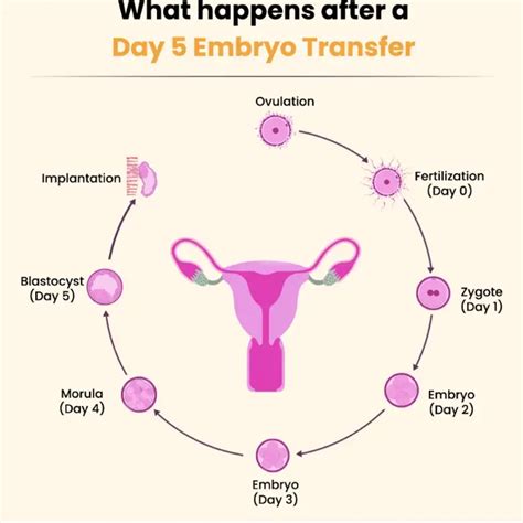 What Day Of The Cycle Does Embryo Transfer What Day Of The Cycle Does Embryo Transfer