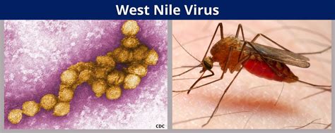 What To Know About West Nile Virus The Illness That Sickened Dr What To Know About West Nile Virus The Illness That Sickened Dr
