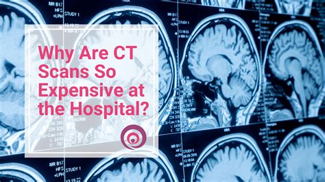 Why Are Ct Scans So Expensive At The Hospital